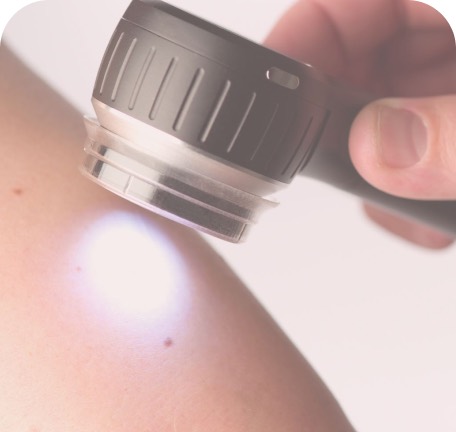 Exame de pinta na pele com dermatoscópio